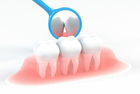 歯茎のメインテナンス