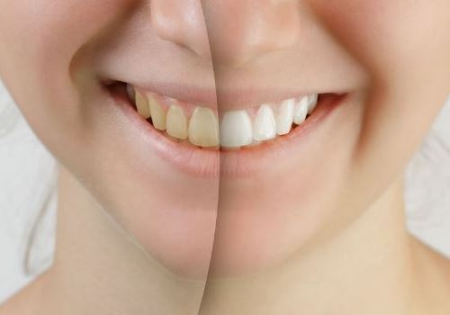 3ページ目 お役立ち情報 金沢市諸江町で歯周病 かみ合わせ 小児歯科 予防歯科に取り組む竹多歯科医院